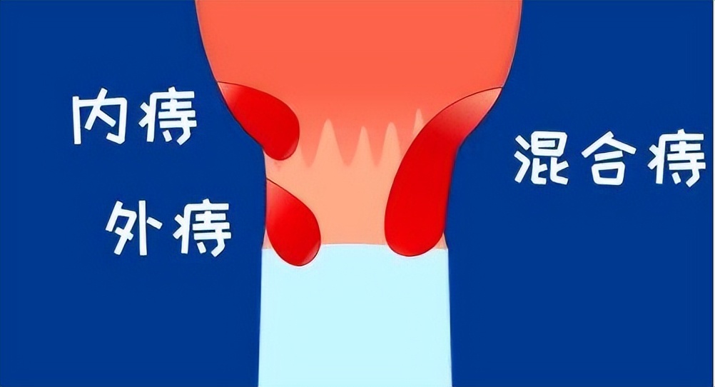 你有洗屁股的习惯吗,你有洗屁屁的习惯吗