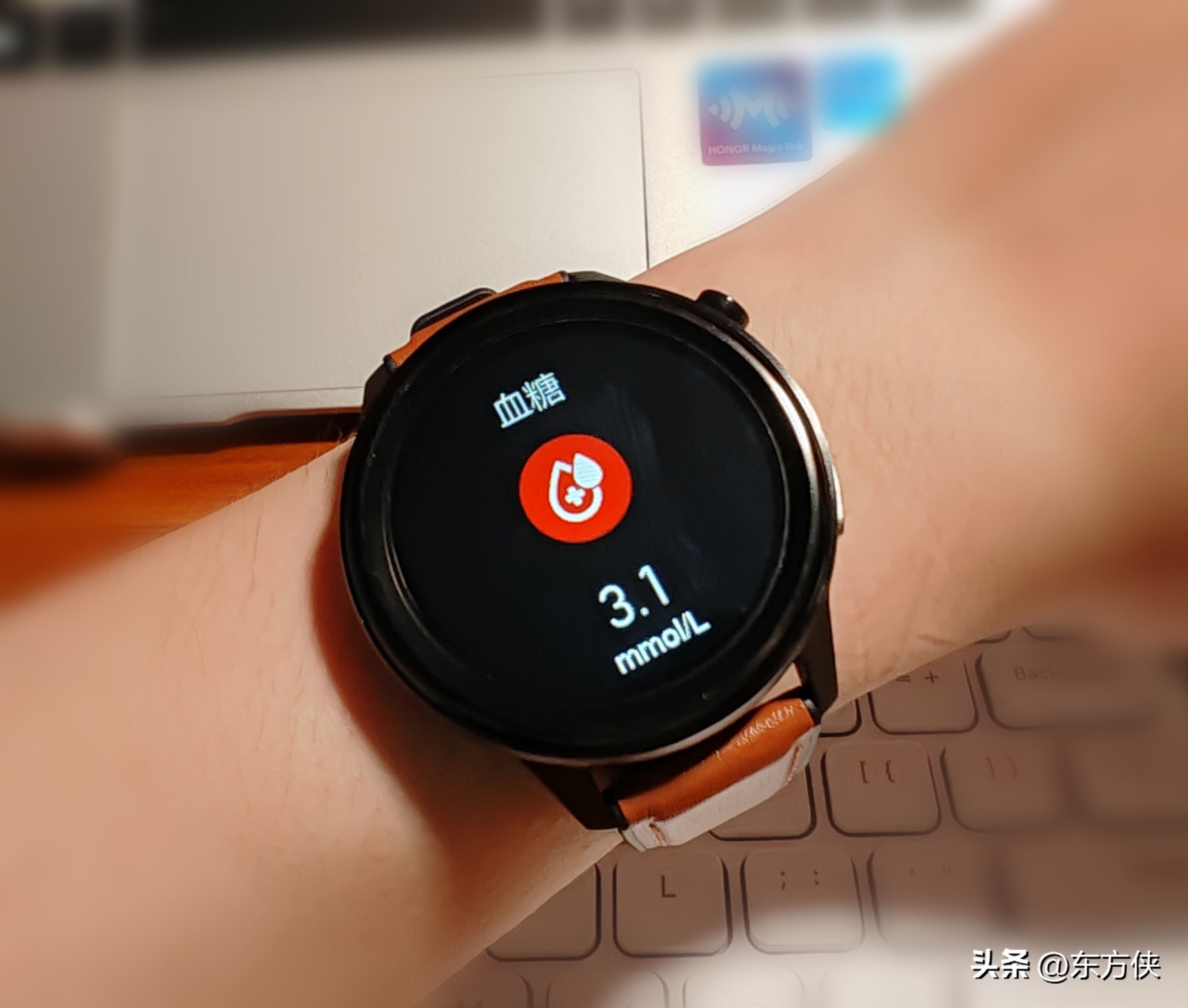 DidoE55Pro远程版智能手表深度评测：无创血糖，守护健康