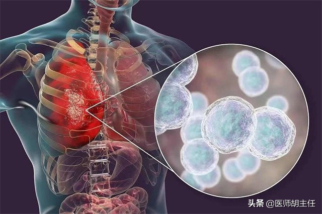“甲硝唑”便宜又好用，能治什么病？医生：对这5种疾病效果很好