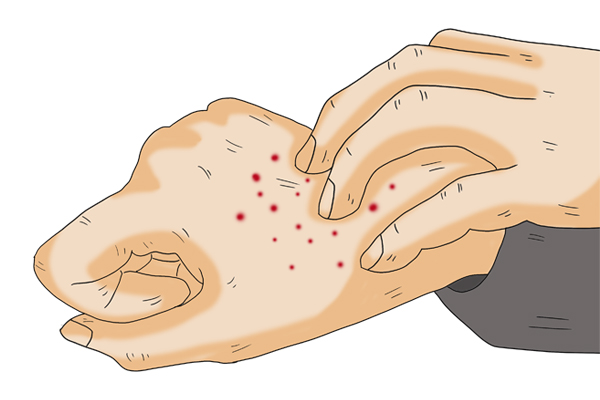 身体信号告诉你缺什么元素,身体信号告知你缺什么维生素
