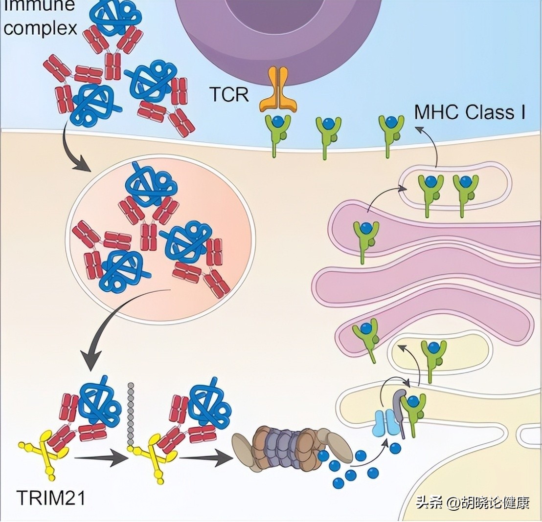 狼疮肾炎补体c4低是狼疮复发吗,狼疮性肾炎诊断的特异性抗体指标