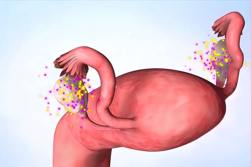 “外阴癌”癌前病变?提醒女性:出现这4种异常，要引起注意