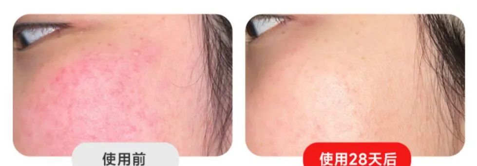 全网爆款美容仪,红光灯美容仪推荐