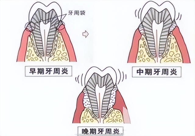 全网热门电动牙刷测评：六大维度深度实测，精准排雷