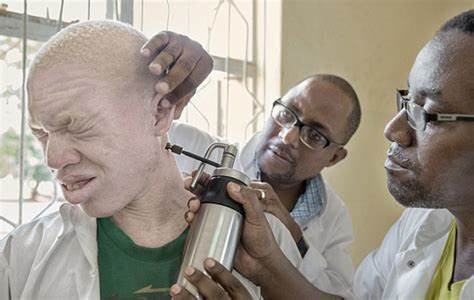 非洲版“唐僧”：血液堪比黄金遗骸可卖上百万，警方束手无策