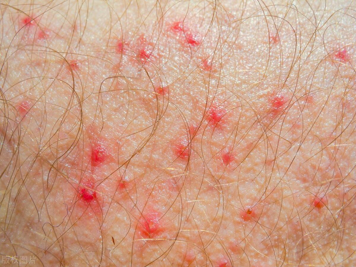 润滑剂对夫妻俩都有伤害吗？医生直言：注意好3点，不必过于烦恼