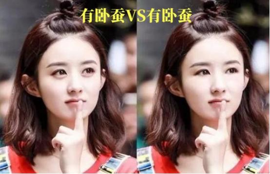 怎样区分卧蚕和眼袋最简单的方法,如何区别眼袋和卧蚕