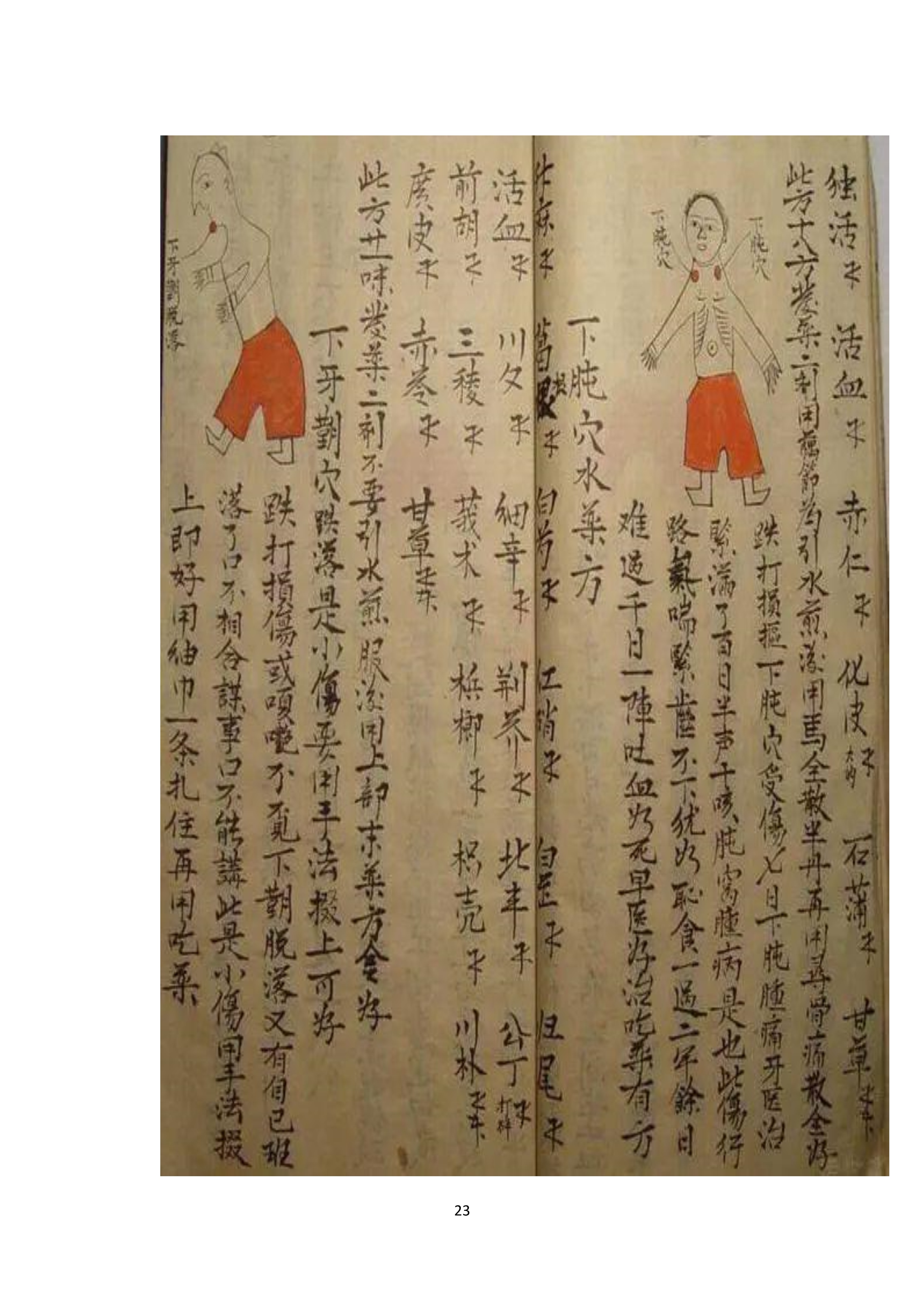 中医古书籍清代带图且内容非常好的手抄跌打损伤良方