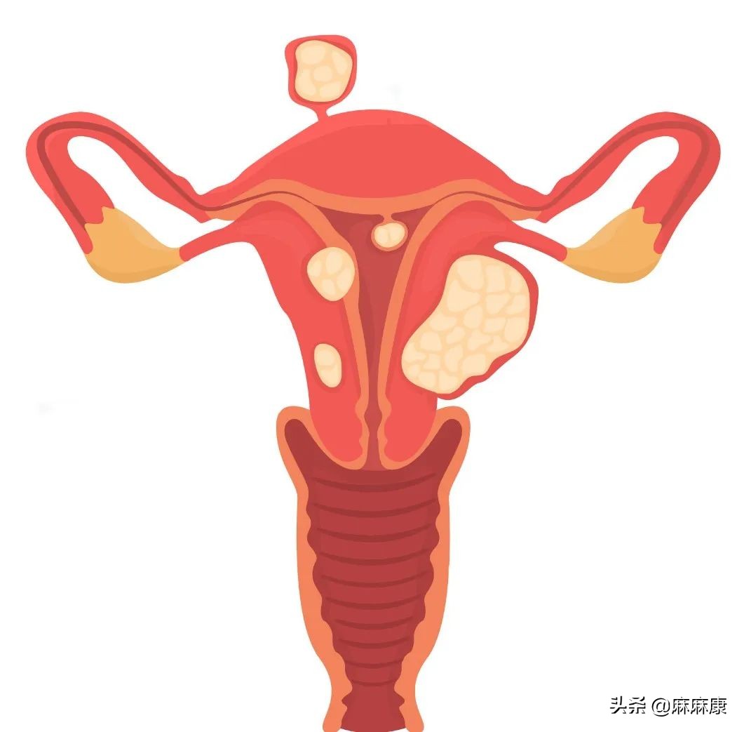 同房出血怎么办?这些措施很重要