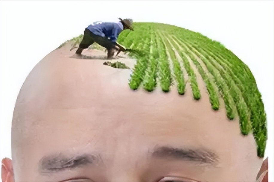 蔓迪米诺地尔5%生发液真的有用吗,生发液真的有用吗知乎