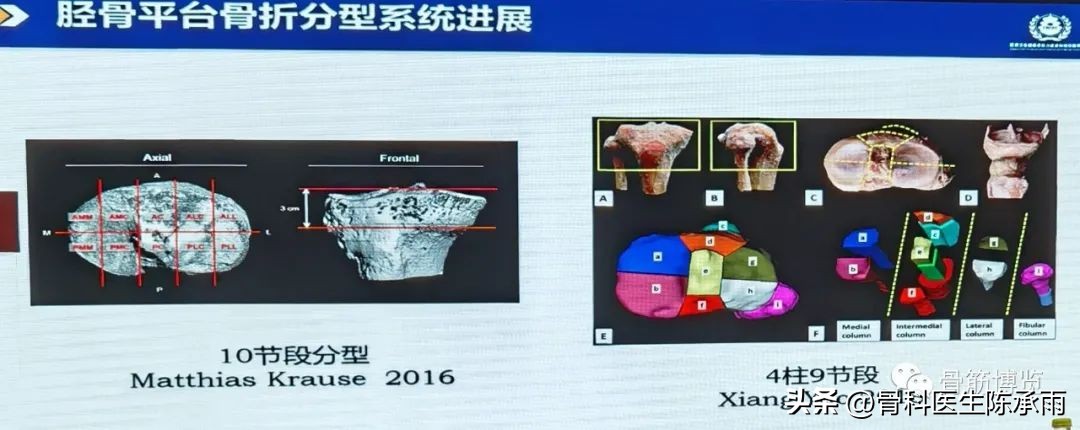 国家卫健委主办的骨创伤专项能力培训项目----下肢损伤学习班