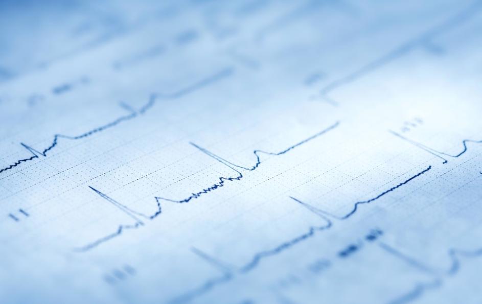 心电图机干扰信号过大的原因,心电伪差一般是指哪些干扰