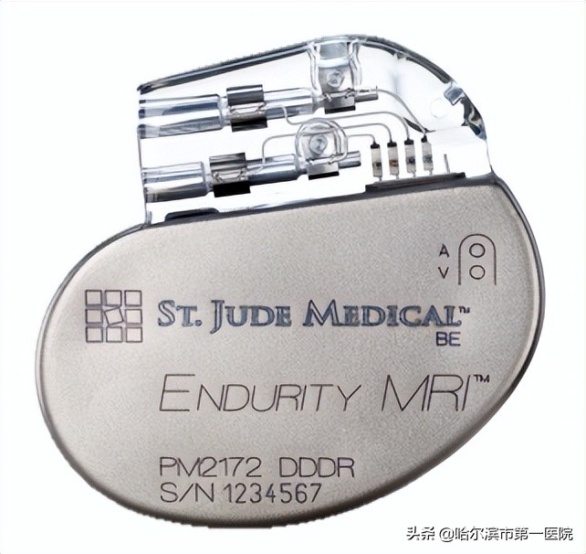 哈尔滨市第一医院心律失常起搏治疗开启新时代为高龄老人植入“抗核磁全自动超大电池容量”心脏双腔起搏器