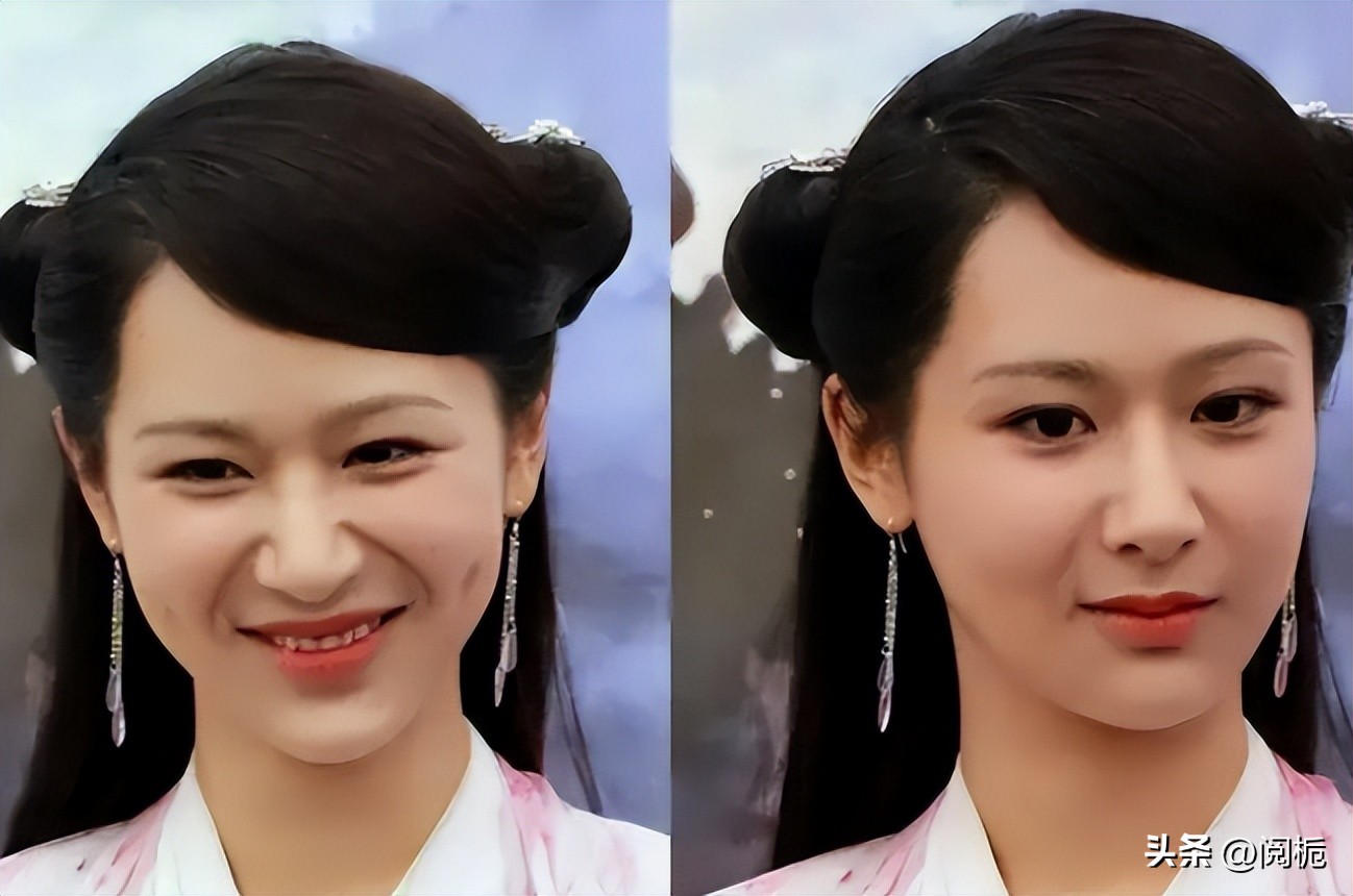 靠换脸逆天改命的六位女星,长得歪瓜裂枣整得美若天仙的明星