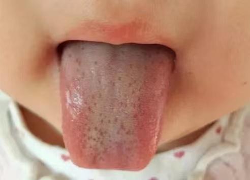 宝宝积食不爱吃饭体质差怎么调理,孩子有积食的危害有哪些