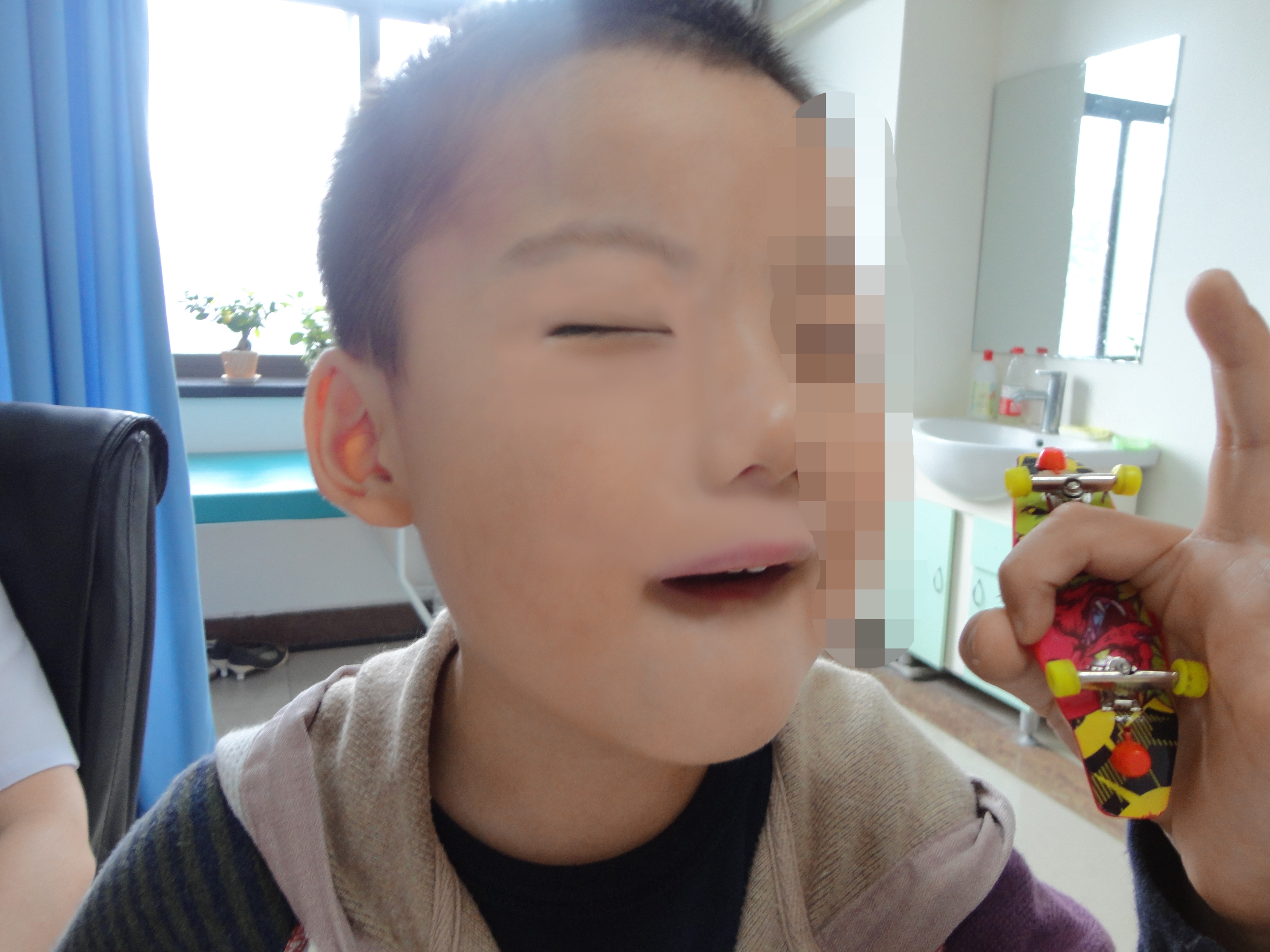 儿童眼皮白癜风能自动痊愈吗,眼睛白癜风睫毛也白了能治好吗