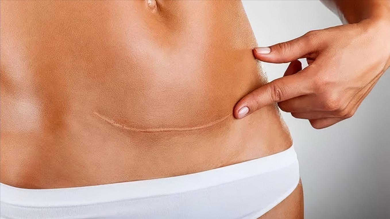 大妈上厕所正用力，身体掉下一块“肉”？医生坦言：这是你的子宫