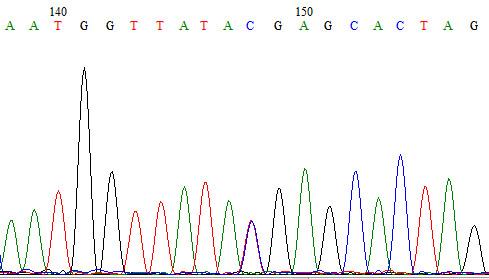 黄疸遗传代谢性疾病,遗传代谢性黄疸怎么治疗