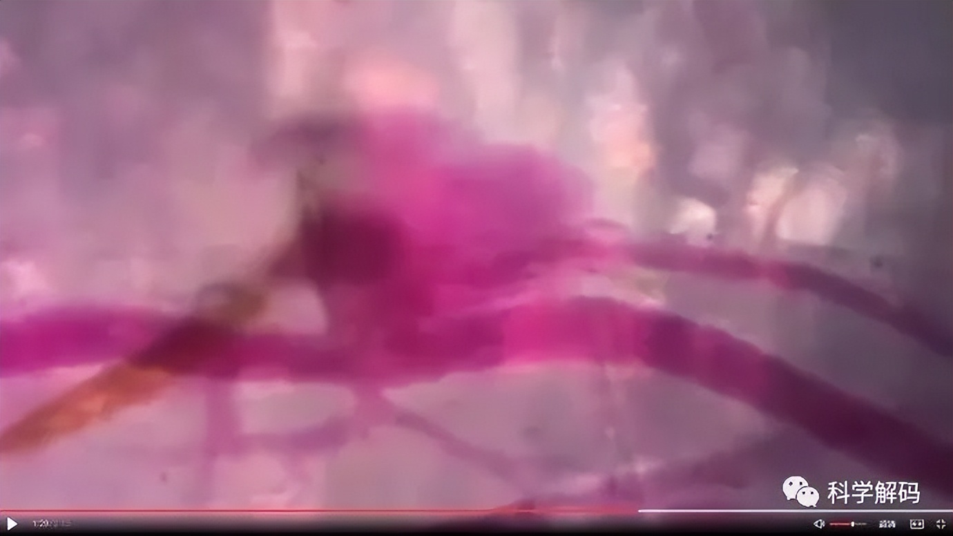 蚊子的嘴解剖,蚊子的内脏解剖照片