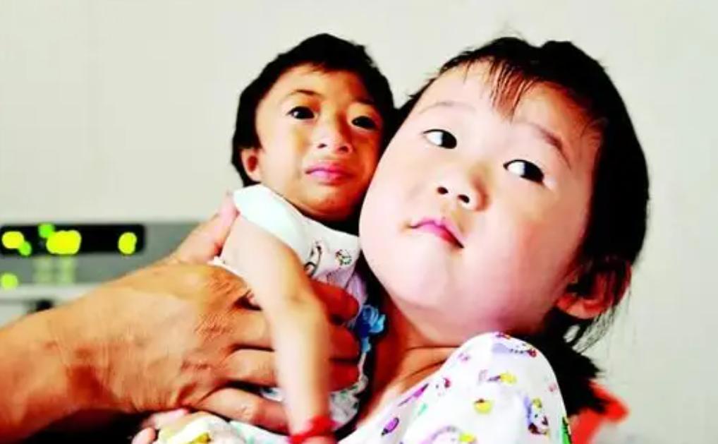 2009年，湖南妈妈生下2斤重特殊女儿，叫出租车被拒载：坐不下