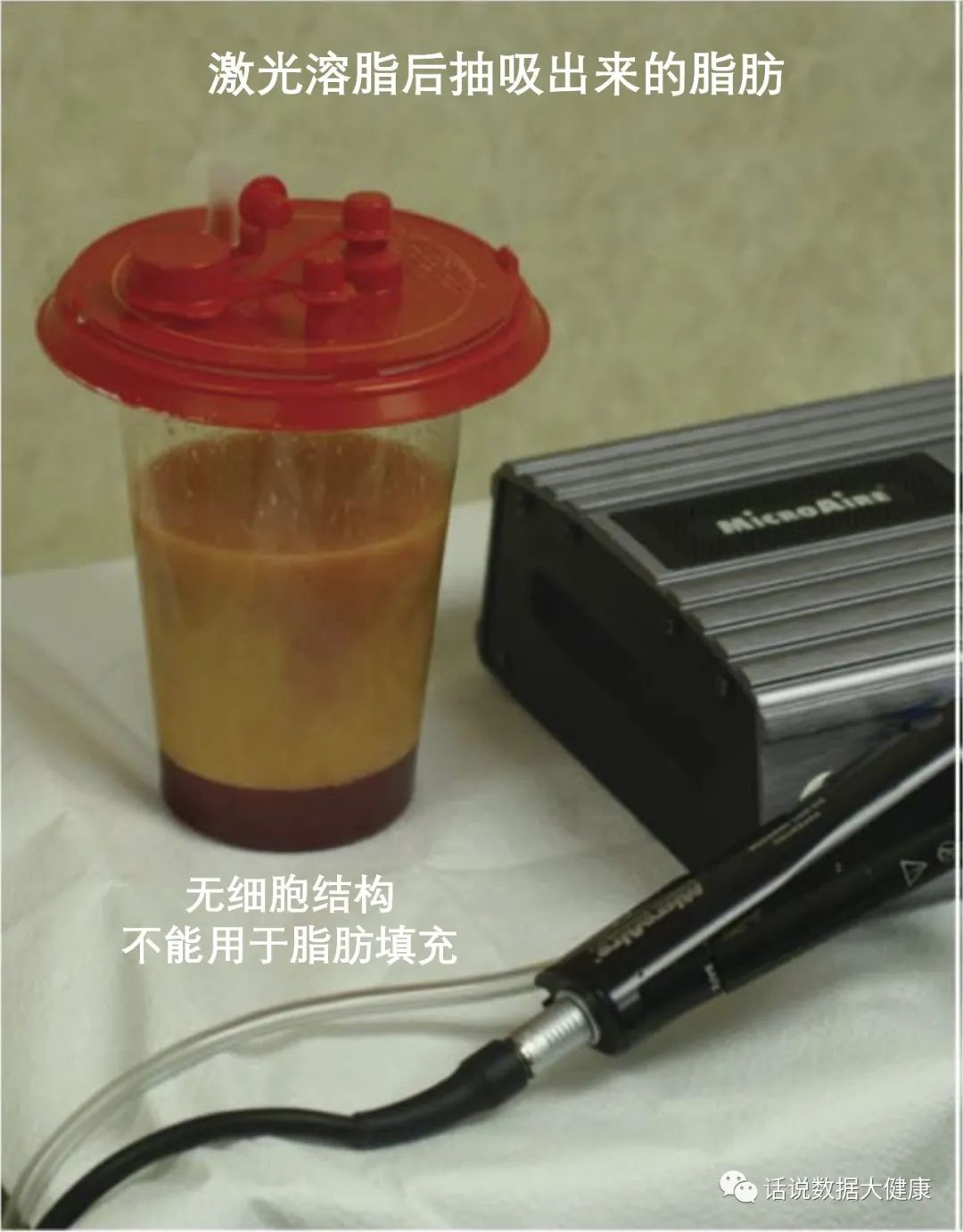 激光减脂，又一个明星医美产品，效果如何？