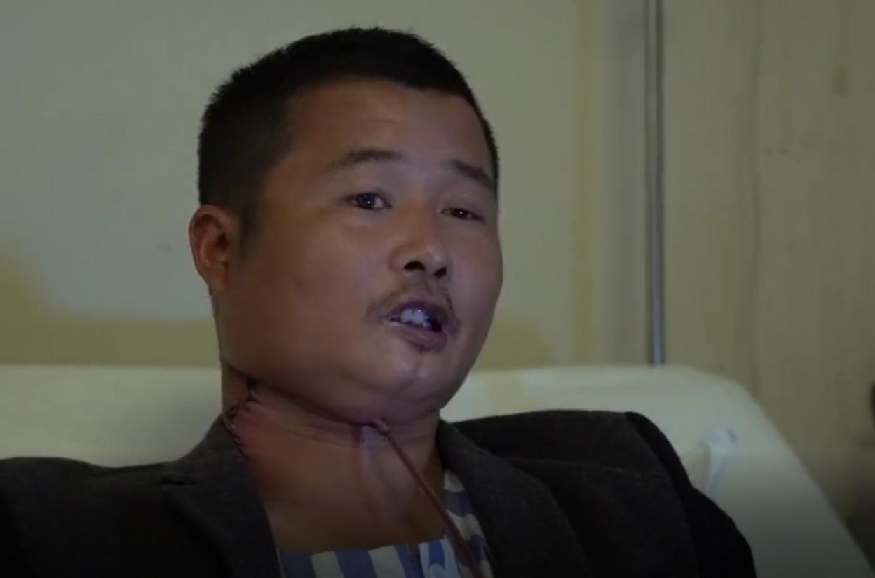 槟榔的危害科学分析,槟榔的危害有多大资料