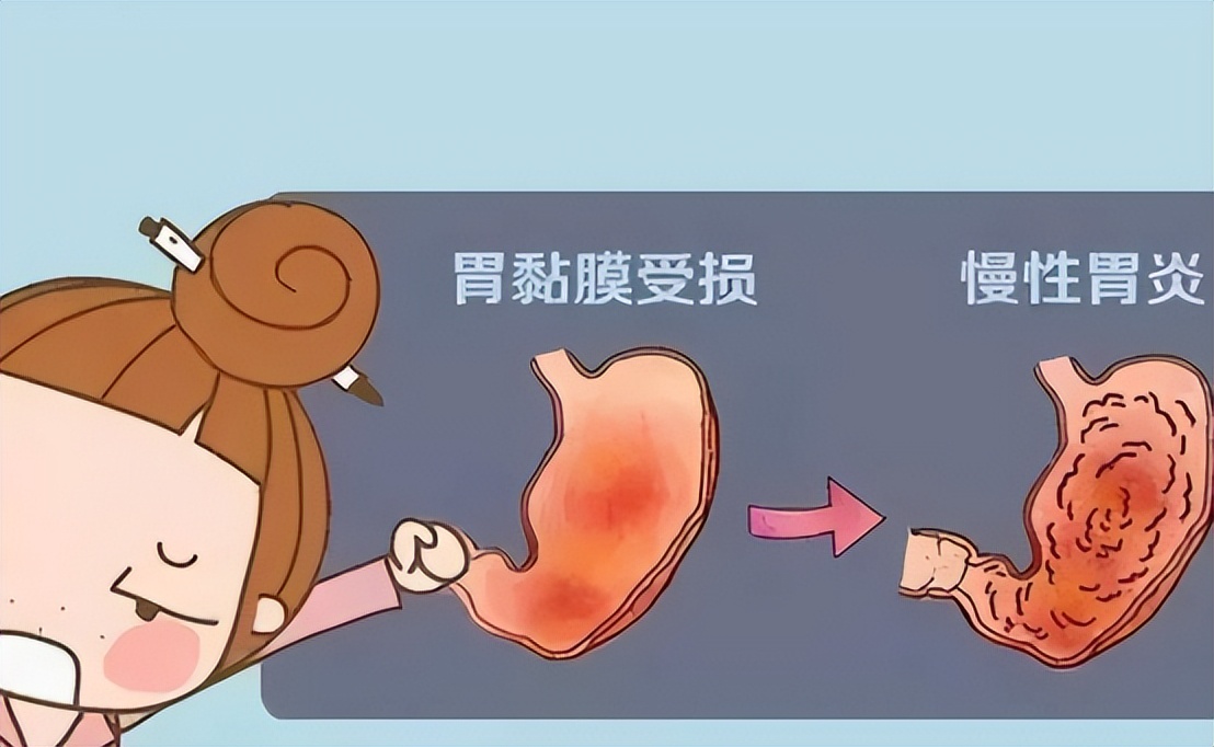 慢性胃炎中医治疗还是西医治疗,慢性胃炎的中医药诊疗方法有哪些