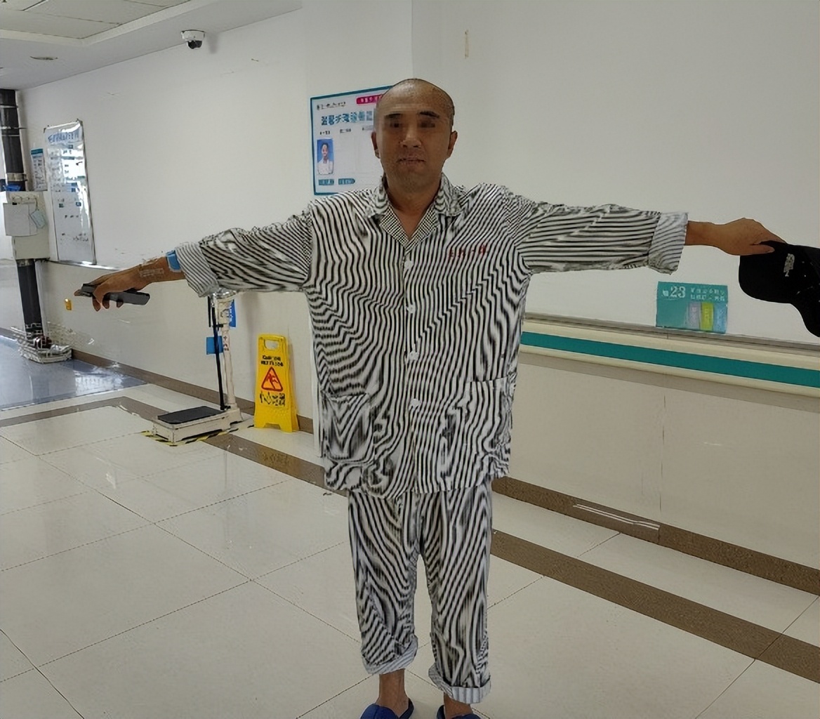 癫痫病灶可能有几个,癫痫频发