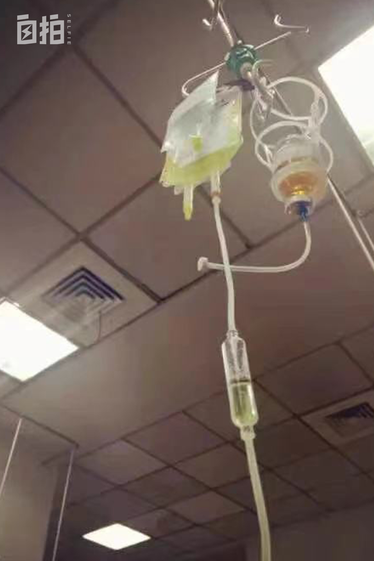 我，小城女孩，29岁失聪，为恢复听力，靠自己一年半攒30万手术费