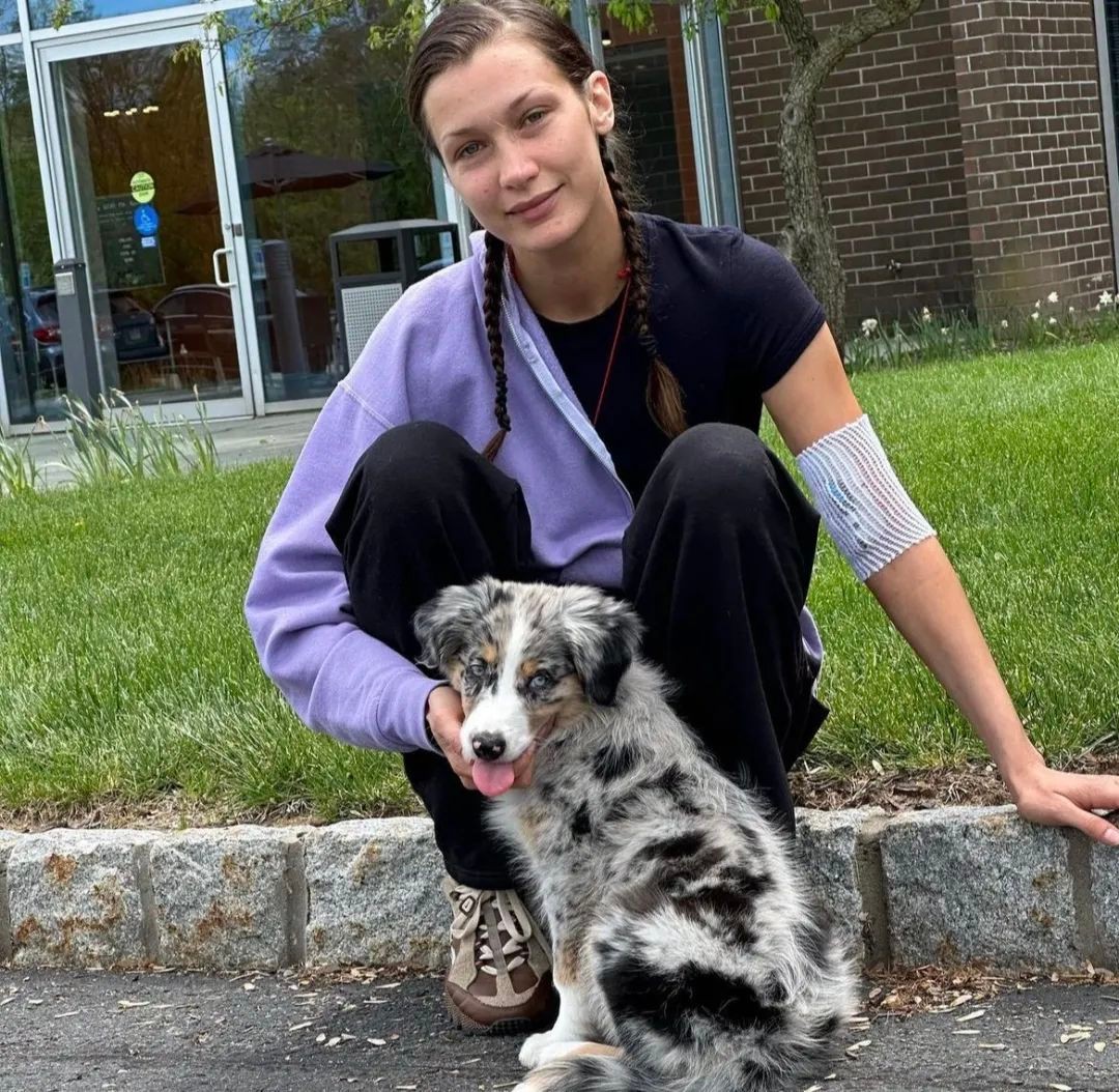 贝拉哈迪德遗传病,贝拉哈迪德莱姆病