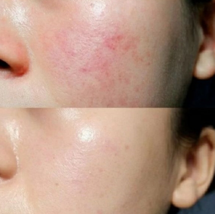 孕期水乳排行榜前十名,孕期水乳测评红榜最可靠的博主