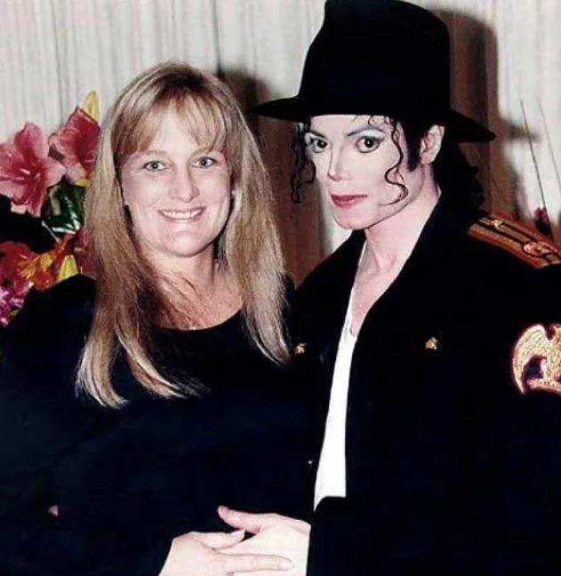 迈克尔杰克逊去世得了什么疾病,迈克杰克逊儿子遗传白化病