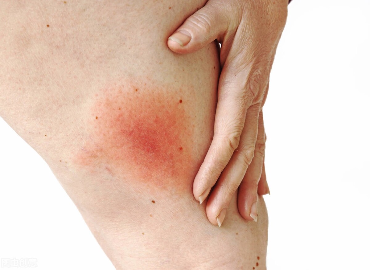 认清“阿莫西林”，只对这5种病有效，乱用、滥用或对身体有害