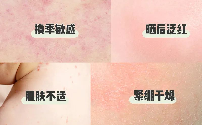 雅漾喷雾为什么卖那么贵,雅漾喷雾和矿泉水有什么区别