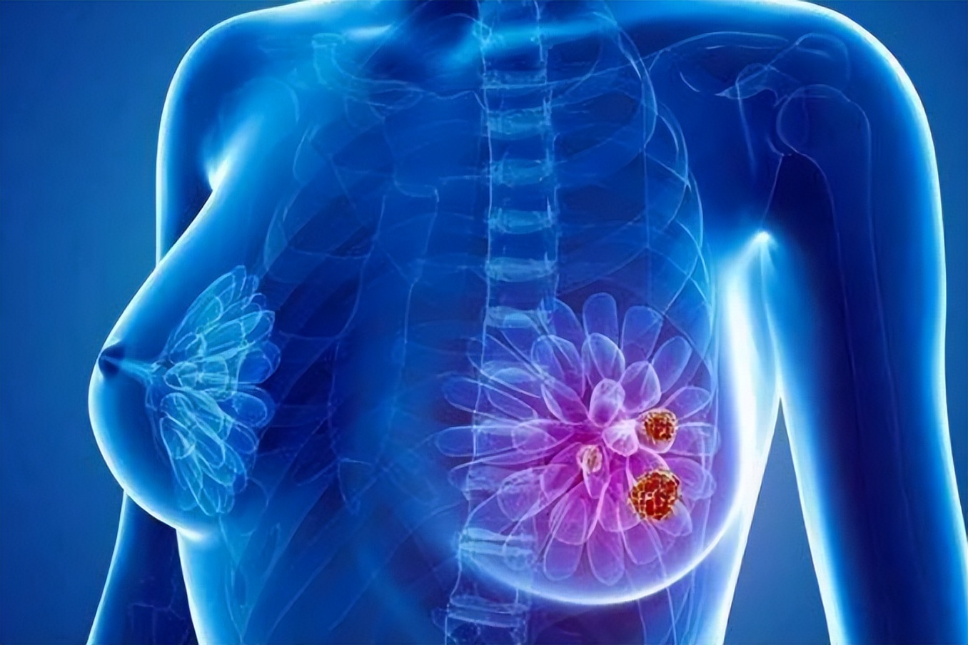 腋窝有个疙瘩是不是艾滋病,腋窝下有疙瘩是艾滋病吗