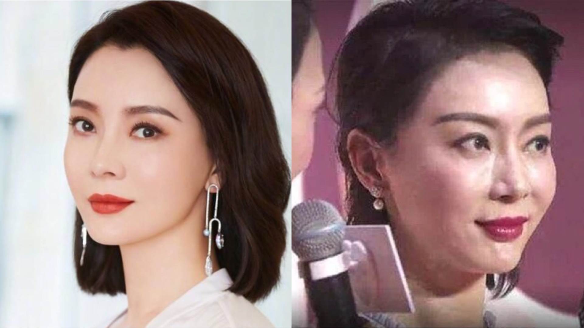 哪些明星整容后遗症越来越严重,整容明星后遗症对比图片