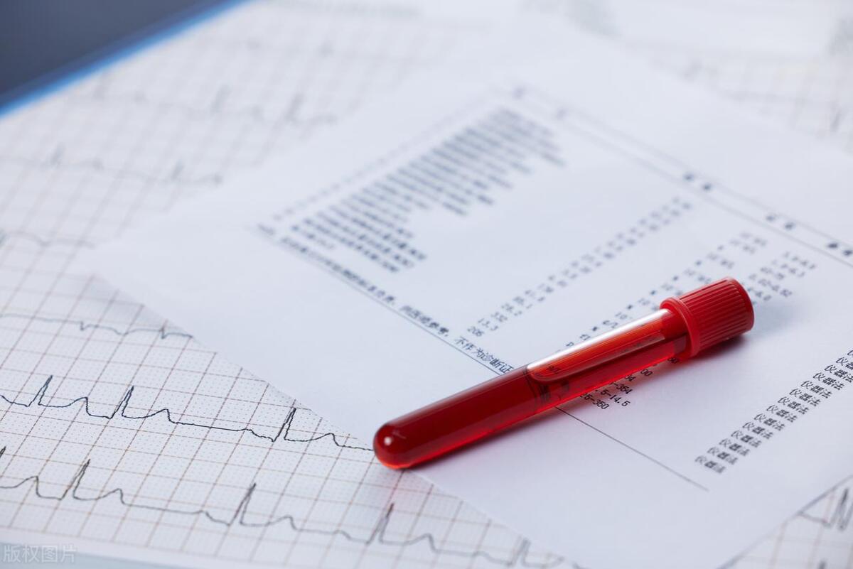 女子去泳池游泳，竟引发急性膀胱炎。医生：治愈后，也要注意预防