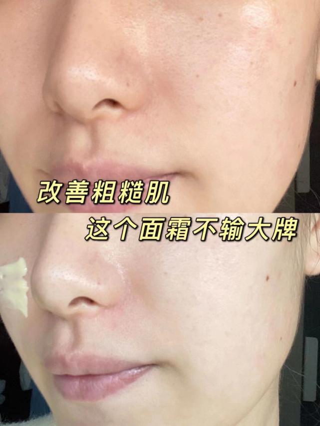 黄皮女生的护肤品,黄皮女生适合用什么护肤品