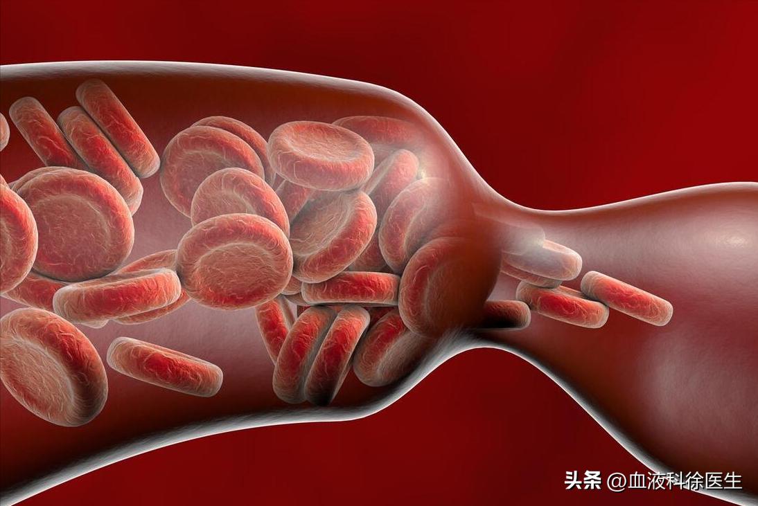 血栓来临腿部先知,血栓病手脚有什么症状