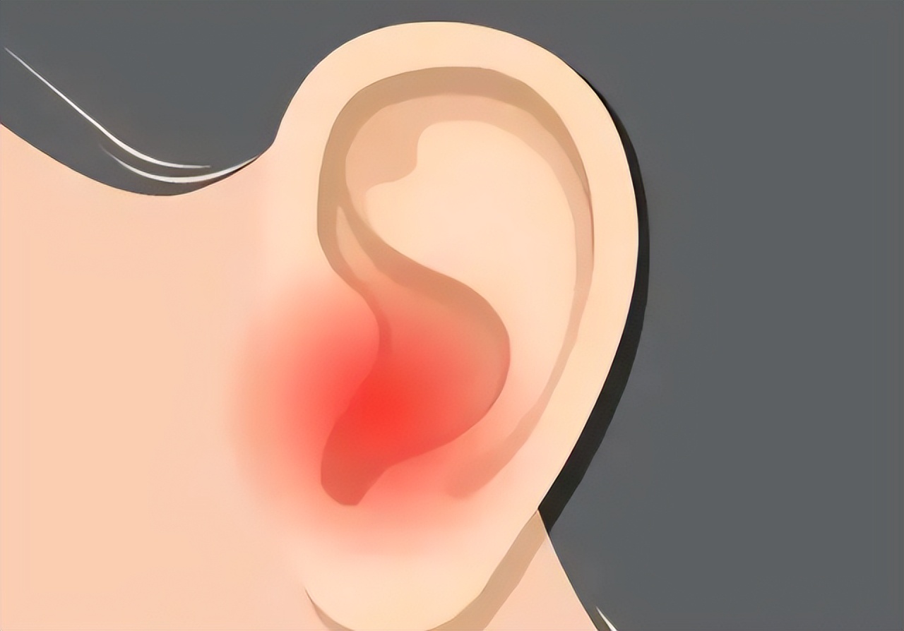 耳朵里面发痒怎么回事怎么去治疗,耳朵里面有黄色分泌物有臭味发痒