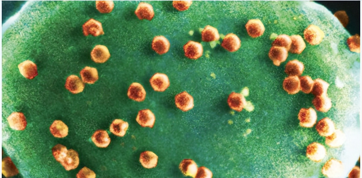 一物降一物疾病的天敌,一物降一物专家