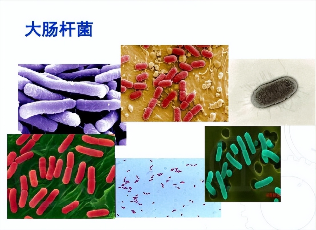 医院内尿路感染常见的诱因,尿路感染最严重的后果