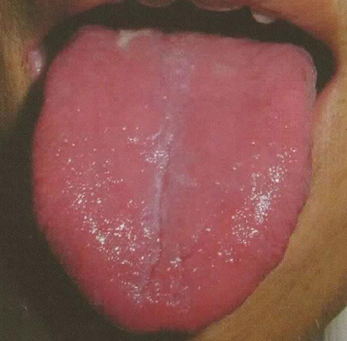 中医认为糖尿病的最好治疗方法,中医治疗糖尿病有几种治疗方案