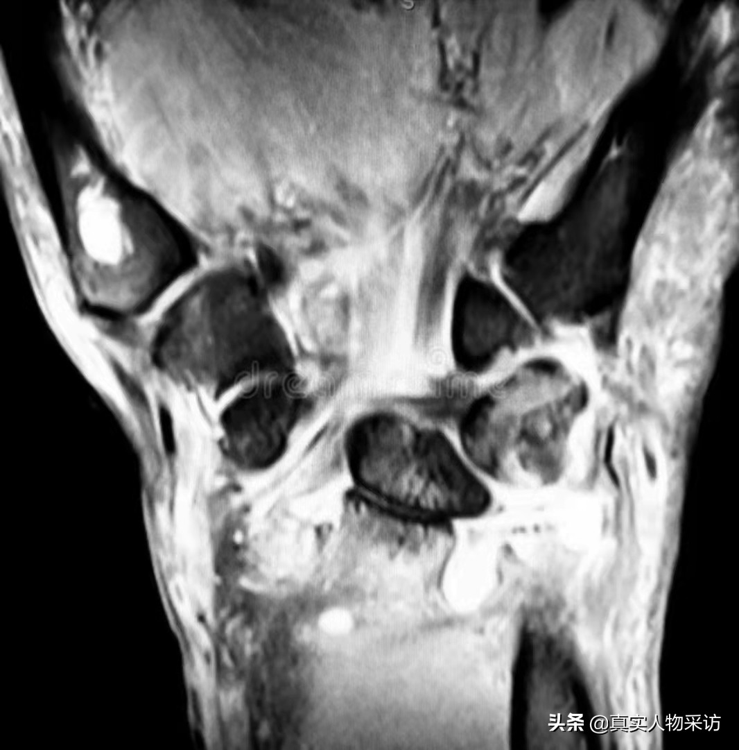 父亲千里送儿参军返乡离奇失踪,我儿子当兵在部队失联了