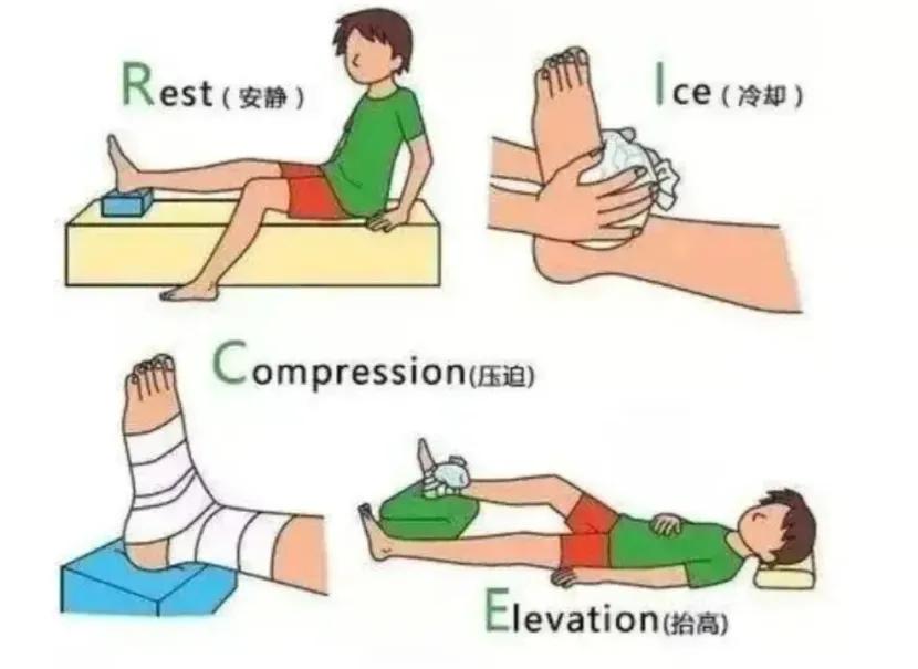 急性踝关节扭伤后绷带绑法,急性踝关节扭伤针灸治疗