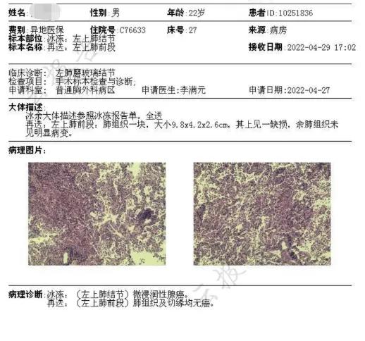 因癌症去世的妈妈,母亲肺癌子女查出磨玻璃结节