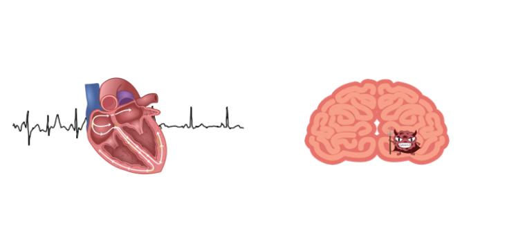 射频消融北医三院,省立三院房颤手术