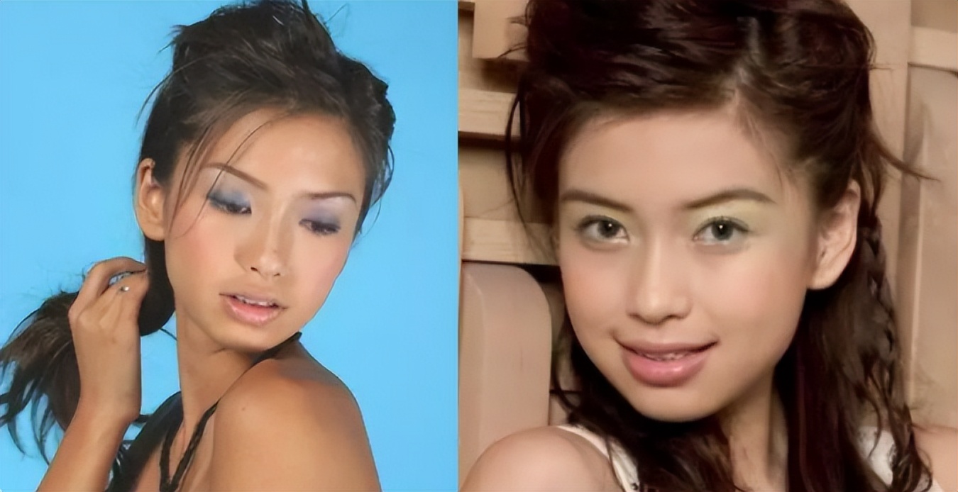 怎么不整容就能成为小v脸,不用整容也能变v脸吗