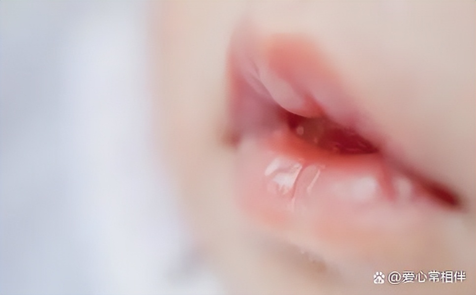 孩子嘴唇干老舔都红了怎么办,孩子嘴唇干起皮用什么药