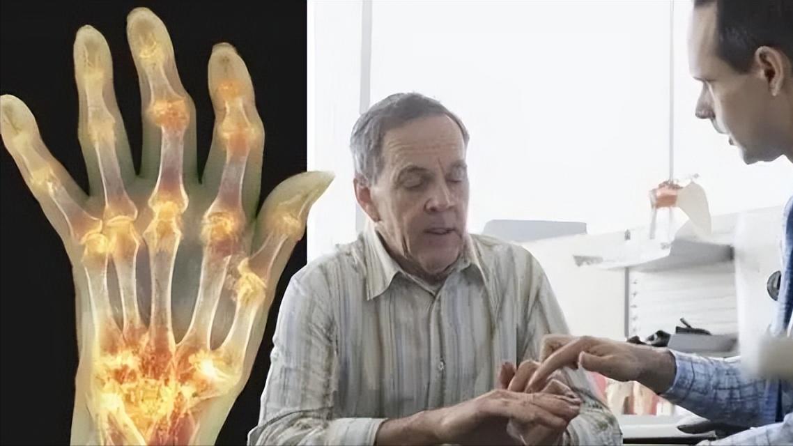 老是手指疼是什么原因,经常手指肿痛是怎么回事